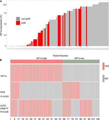 HIF1α Regulates IL17 Signaling Pathway Influencing Sensitivity of Taxane-Based Chemotherapy for Breast Cancer